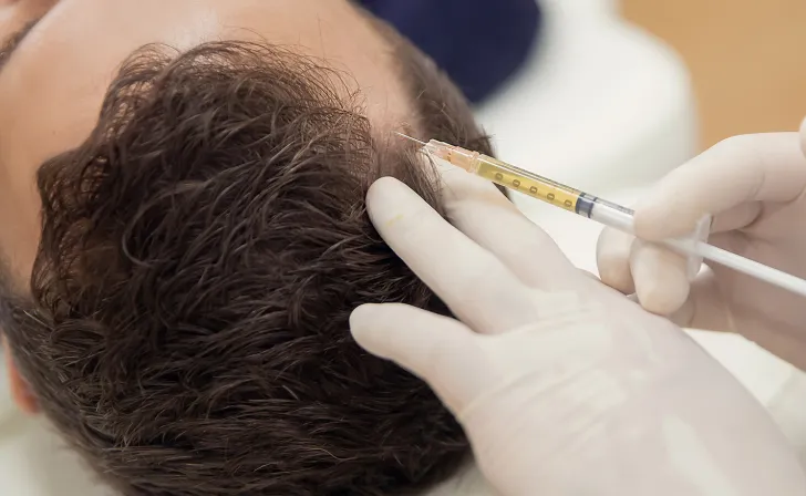 Platelet Rich Plasma