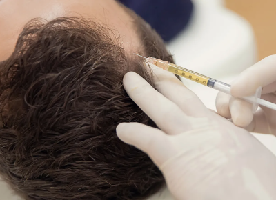 Platelet Rich Plasma