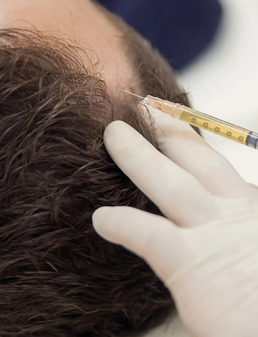 Platelet Rich Plasma