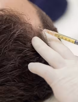 Platelet Rich Plasma